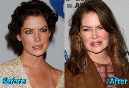 A picture of Lara Flynn Boyle before (left) and after (right).